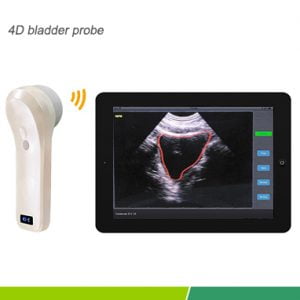 SCANNER VESCICALE