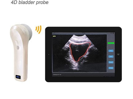 scanner vescicale a ultrasuoni